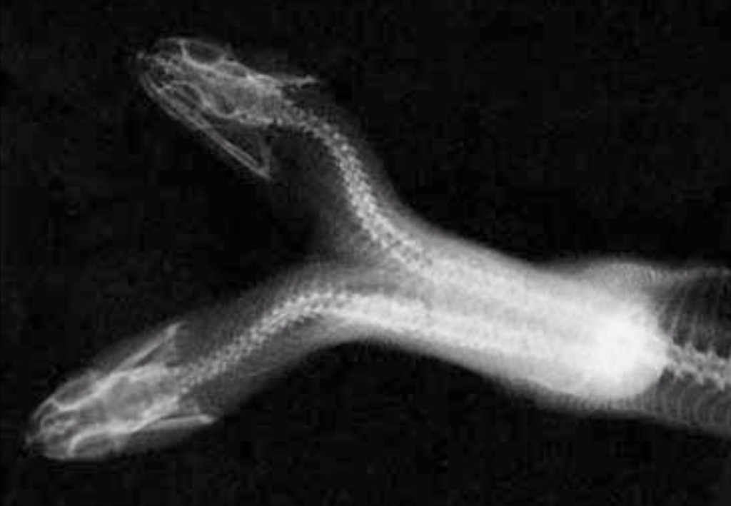 Two headed snake X-ray
